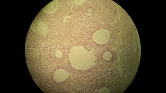 Ovary Graafian Follicle Slides - Ovary Graafian Follicle 009 100X